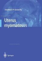Uterus myomatosus - cover
