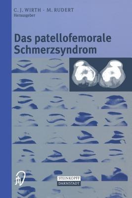 Das patellofemorale Schmerzsyndrom - cover