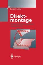 Direktmontage: Handbuch über die Verarbeitung ungehäuster ICs