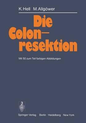 Die Colonresektion - K. Hell,M. Allgöwer - cover