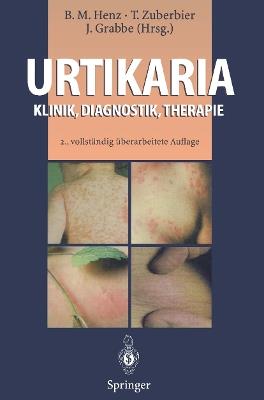 Urtikaria: Klinik, Diagnostik, Therapie - cover