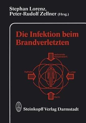Die Infektion beim Brandverletzten - cover