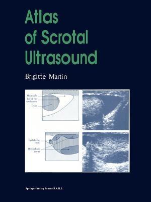 Atlas of Scrotal Ultrasound - Brigitte Martin - cover