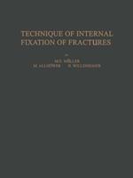 Technique of Internal Fixation of Fractures