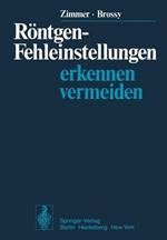 Röntgen-Fehleinstellungen: Erkennen und vermeiden