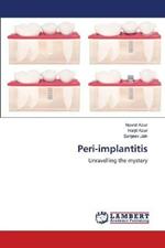 Peri-implantitis