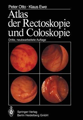 Atlas der Rectoskopie und Coloskopie - P. Otto,K. Ewe - cover