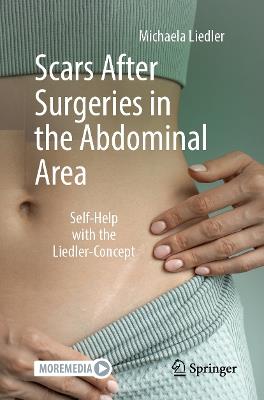 Scars After Surgeries in the Abdominal Area: Self-Help with the Liedler-Concept - Michaela Liedler - cover