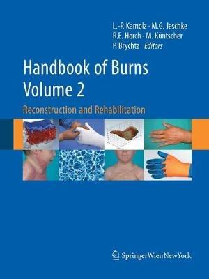 Handbook of Burns Volume 2: Reconstruction and Rehabilitation - cover