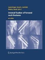 Libro in inglese Internal fixation of femoral neck fractures: An Atlas 