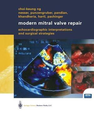 Modern Mitral Valve Repair: Echocardiographic Interpretations and Surgical Strategies - Choi-Keung Ng - cover