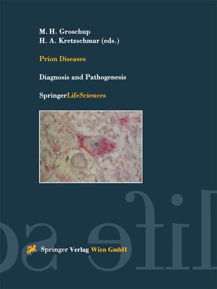 Prion Diseases