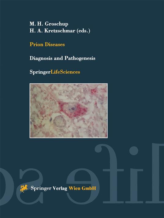 Prion Diseases