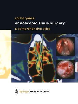 Endoscopic Sinus Surgery: A Comprehensive Atlas - Carlos Yañez - cover