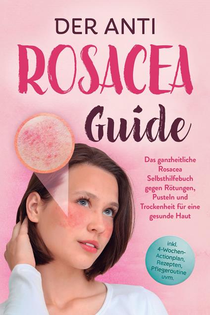 Der Anti Rosacea Guide: Das ganzheitliche Rosacea Selbsthilfebuch gegen Rötungen, Pusteln und Trockenheit für eine gesunde Haut - inkl. 4-Wochen-Actionplan, Rezepten, Pflegeroutine uvm.