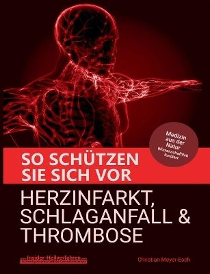 So schützen Sie sich vor Herzinfarkt, Schlaganfall und Thrombose - Christian Meyer-Esch - cover