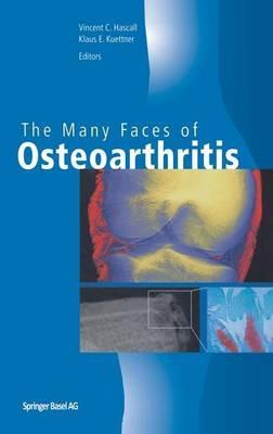 The Many Faces of Osteoarthritis - cover