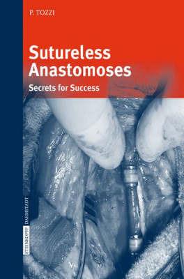 Sutureless Anastomoses: Secrets for Success - Piergiorgio Tozzi - cover