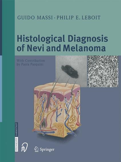 Histological Diagnosis of Nevi and Melanoma
