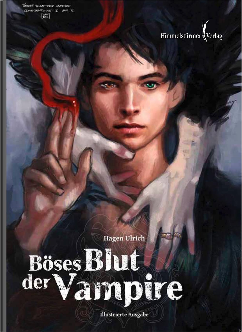 ibs