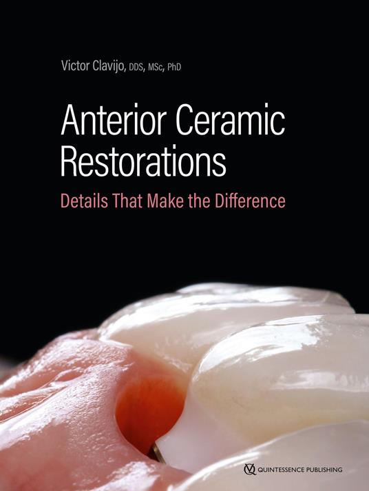 Anterior Ceramic Restorations