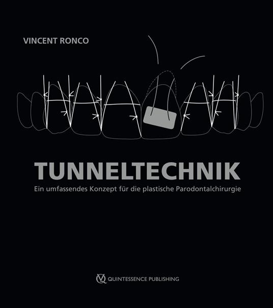 Tunneltechnik