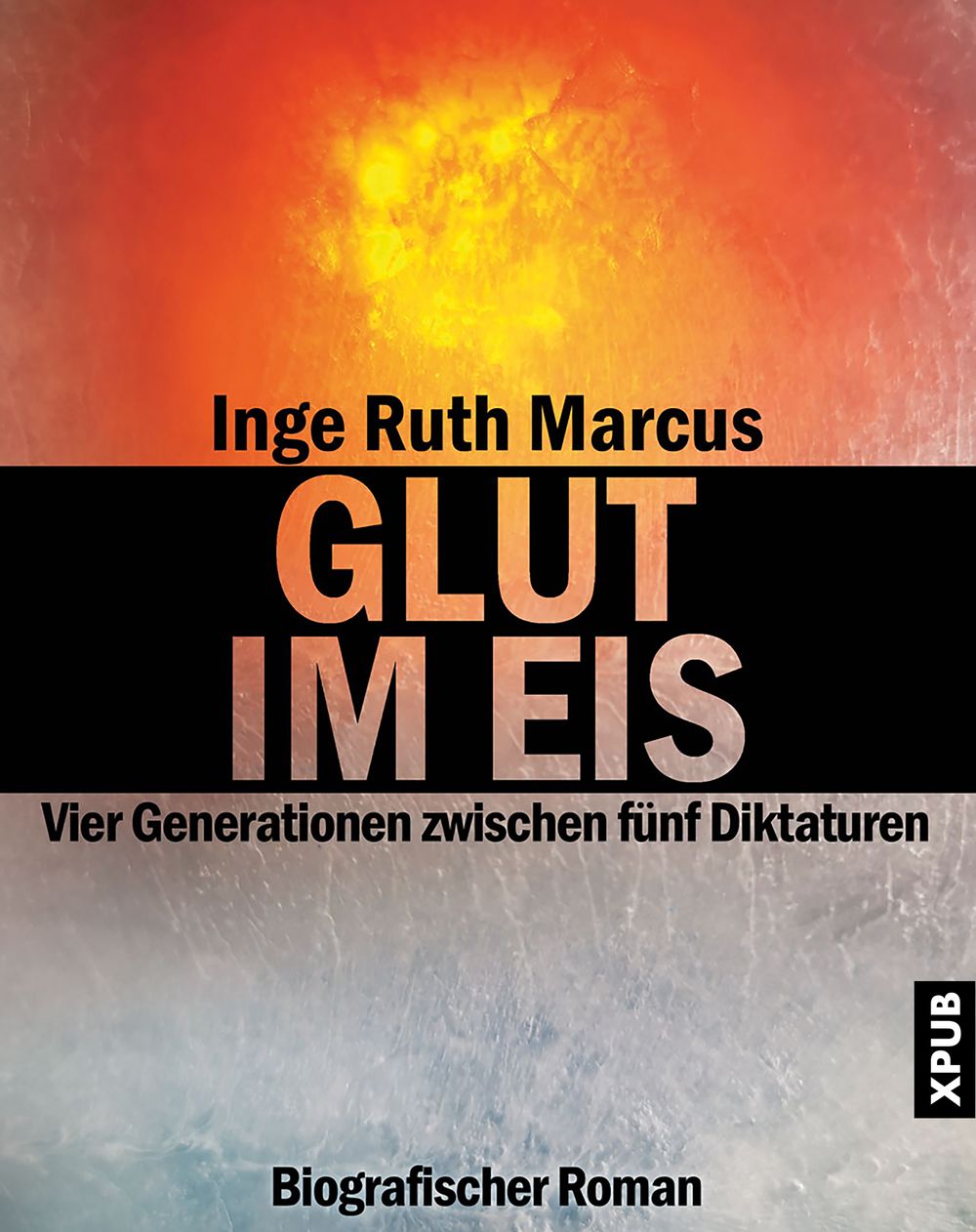 ibs