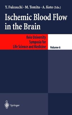 Ischemic Blood Flow in the Brain - cover