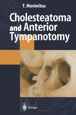 Cholesteatoma and Anterior Tympanotomy - Tamotsu Morimitsu - cover