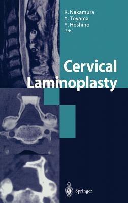 Cervical Laminoplasty - cover