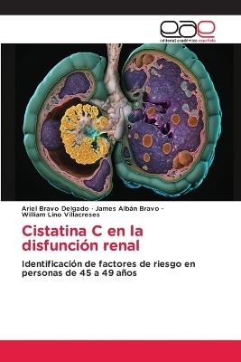 Cistatina C en la disfunción renal - Ariel Bravo Delgado,James Albán Bravo,William Lino Villacreses - cover