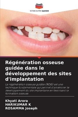 Régénération osseuse guidée dans le développement des sites d'implantation - Khyati Arora,Harikumar K,Rosamma Joseph - cover