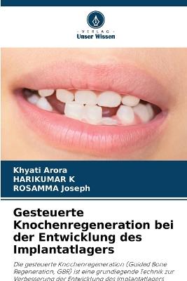 Gesteuerte Knochenregeneration bei der Entwicklung des Implantatlagers - Khyati Arora,Harikumar K,Rosamma Joseph - cover