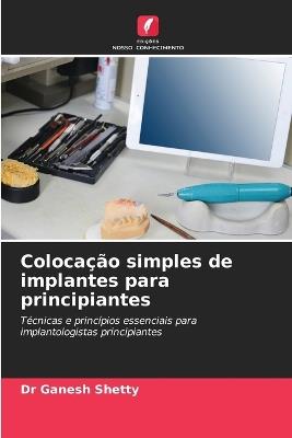 Colocação simples de implantes para principiantes - Ganesh Shetty - cover
