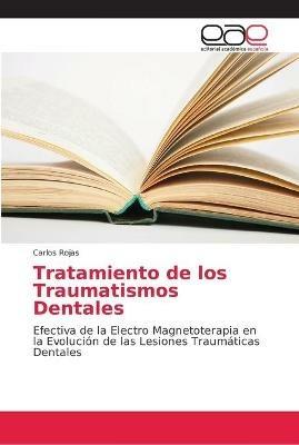 Tratamiento de los Traumatismos Dentales - Carlos Rojas - cover