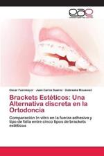 Brackets Esteticos: Una Alternativa discreta en la Ortodoncia