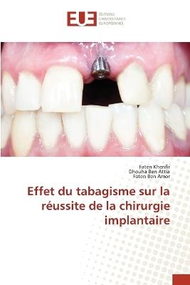 Effet du tabagisme sur la réussite de la chirurgie implantaire - Faten Khenfir,Dhouha Ben Attia,Faten Ben Amor - cover