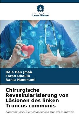 Chirurgische Revaskularisierung von Läsionen des linken Truncus communis - Hèla Ben Jmaà,Faten Dhouib,Rania Hammami - cover