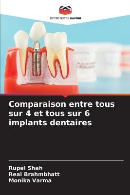Comparaison entre tous sur 4 et tous sur 6 implants dentaires - Rupal Shah,Real Brahmbhatt,Monika Varma - cover