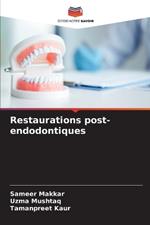 Restaurations post-endodontiques