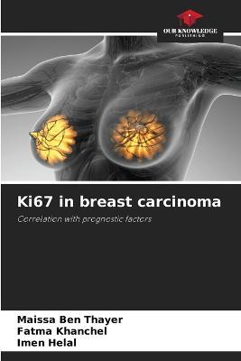 Ki67 in breast carcinoma - Maissa Ben Thayer,Fatma Khanchel,Imen Helal - cover