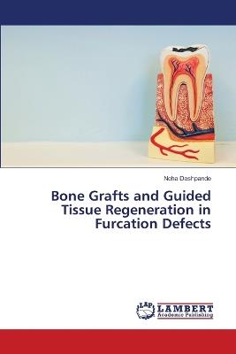 Bone Grafts and Guided Tissue Regeneration in Furcation Defects - Neha Deshpande - cover