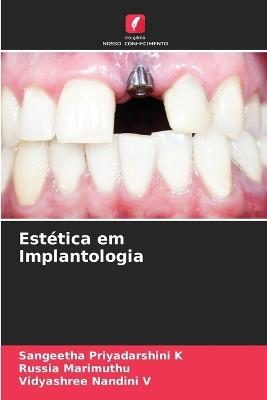 Estética em Implantologia - Sangeetha Priyadarshini K,Russia Marimuthu,Vidyashree Nandini V - cover