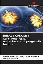 Breast Cancer: Carcinogenesis, metastasis and prognostic factors