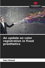 An update on color registration in fixed prosthetics
