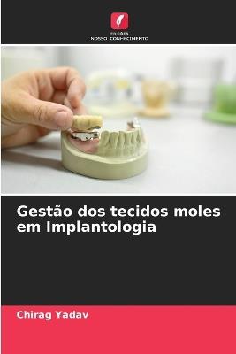 Gest?o dos tecidos moles em Implantologia - Chirag Yadav - cover