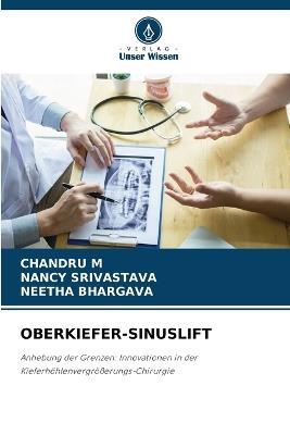 Oberkiefer-Sinuslift - Chandru M,Nancy Srivastava,Neetha Bhargava - cover