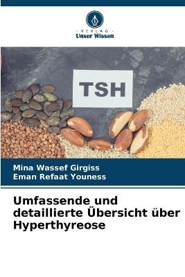 Umfassende und detaillierte ?bersicht ?ber Hyperthyreose - Mina Wassef Girgiss,Eman Refaat Youness - cover