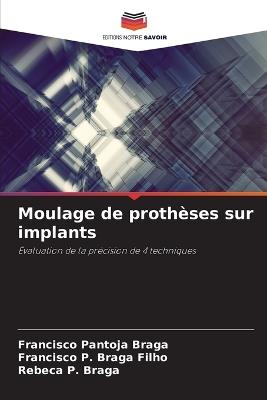 Moulage de proth?ses sur implants - Francisco Pantoja Braga,Francisco P Braga Filho,Rebeca P Braga - cover