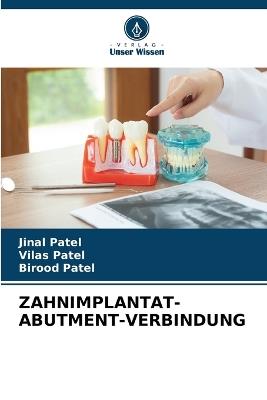 Zahnimplantat-Abutment-Verbindung - Jinal Patel,Vilas Patel,Birood Patel - cover